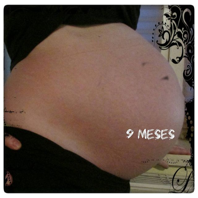 foto de una embarazada a los nueve meses sin ningún estría. Las estrías durante el embarazo son algo muy común. 